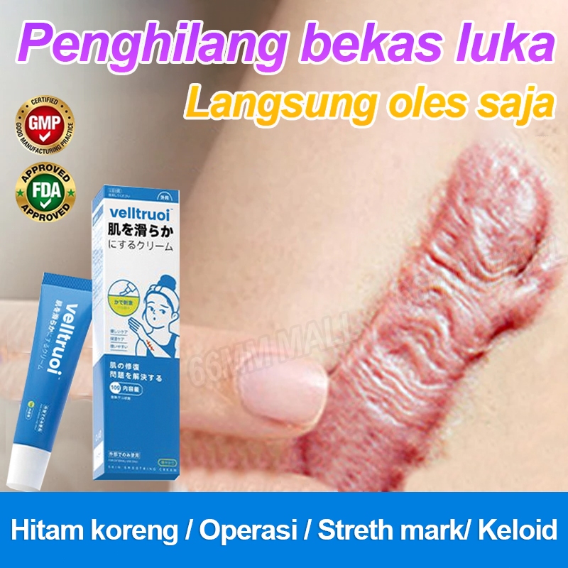 Salep Penghilang Bekas Luka Anak Menghilangkan Bekas Luka Menghitam Obat Keloid Di Kaki/Wajah Penghi