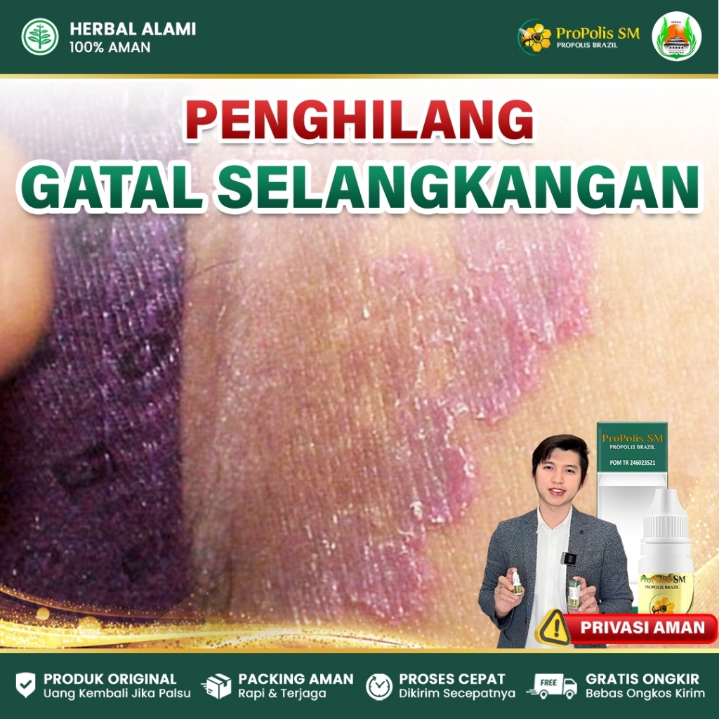 Obat Gatal Selangkangan, Infeksi Jamur Candida, Kurap, Dermatitis, Kutu Kelamin - Propolis SM Asli