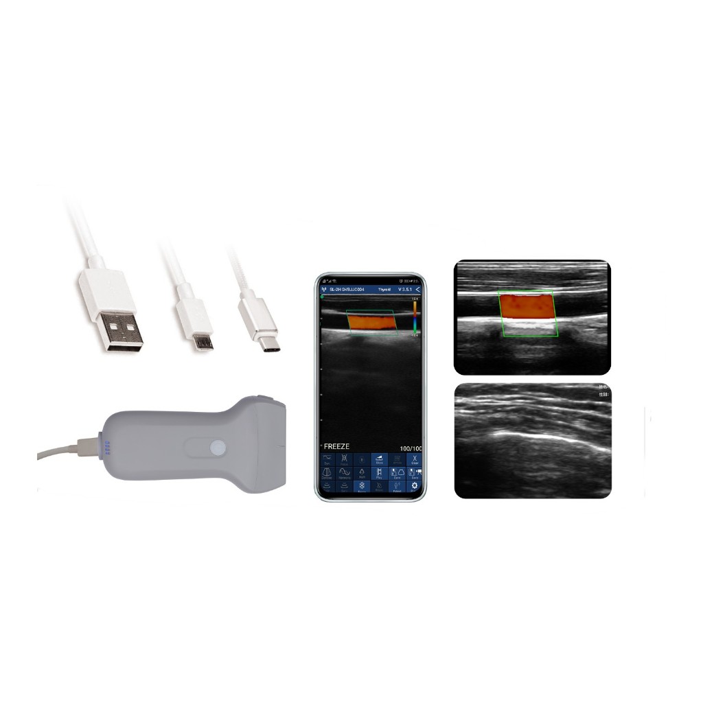 Alat Medis USG Portable Linear Wireless/USB Probe Ultrasound Scanner - Pemindai Ultrasonografi Probe