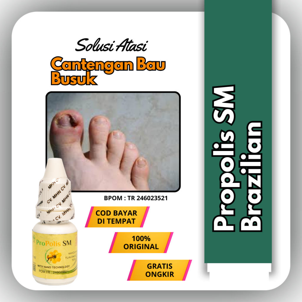 Propolis SM Brazilian - Obat Cantengan Obat Kuku Anti Infeksi Jamur Bakteri Cantengan Bau Busuk Gata