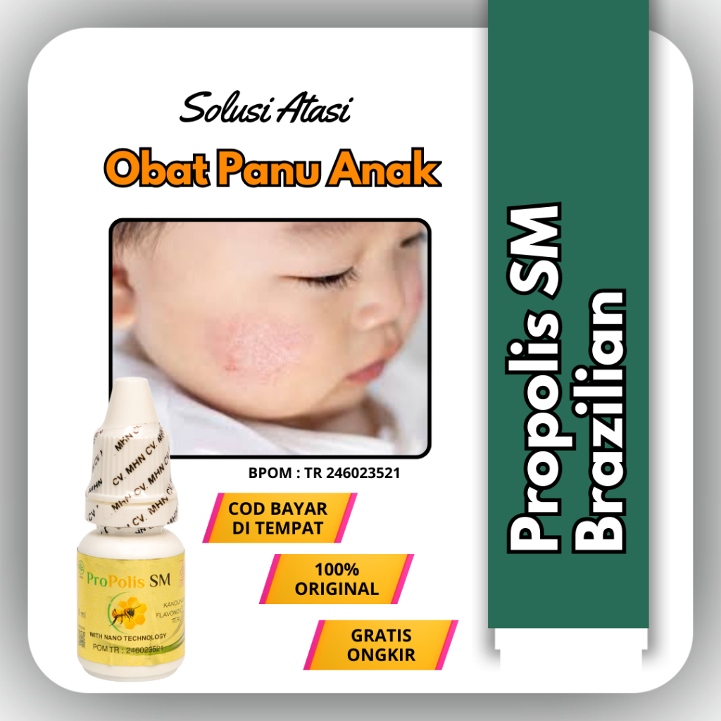 Propolis SM Brazilian - Obat Panu Anak Salep Gatal Kulit Selangkangan Panu Kadas Kurap Exim Jamur Ku