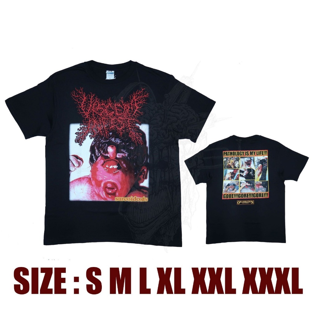 TSHIRT - VISCERA INFEST - SARCOIDOSIS