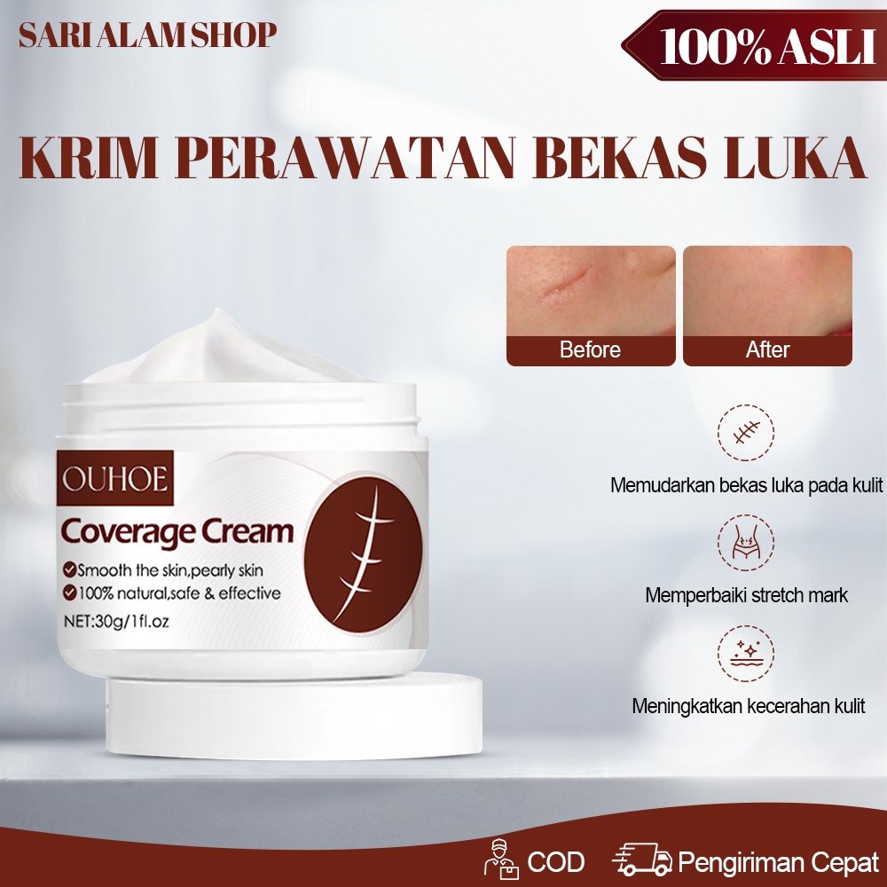 Ouhoe Salep Penghilang Bekas Luka 30g Obat Penghilang Bekas Luka Penghilang Bekas Luka Hitam Penghil