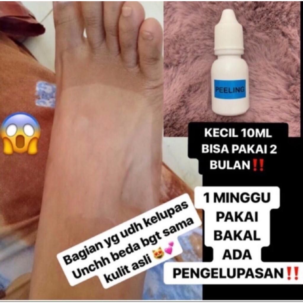 Body Peeling T15, T20, T35 - Pengelupasan Kulit, Pemutihan, Perawatan Kulit