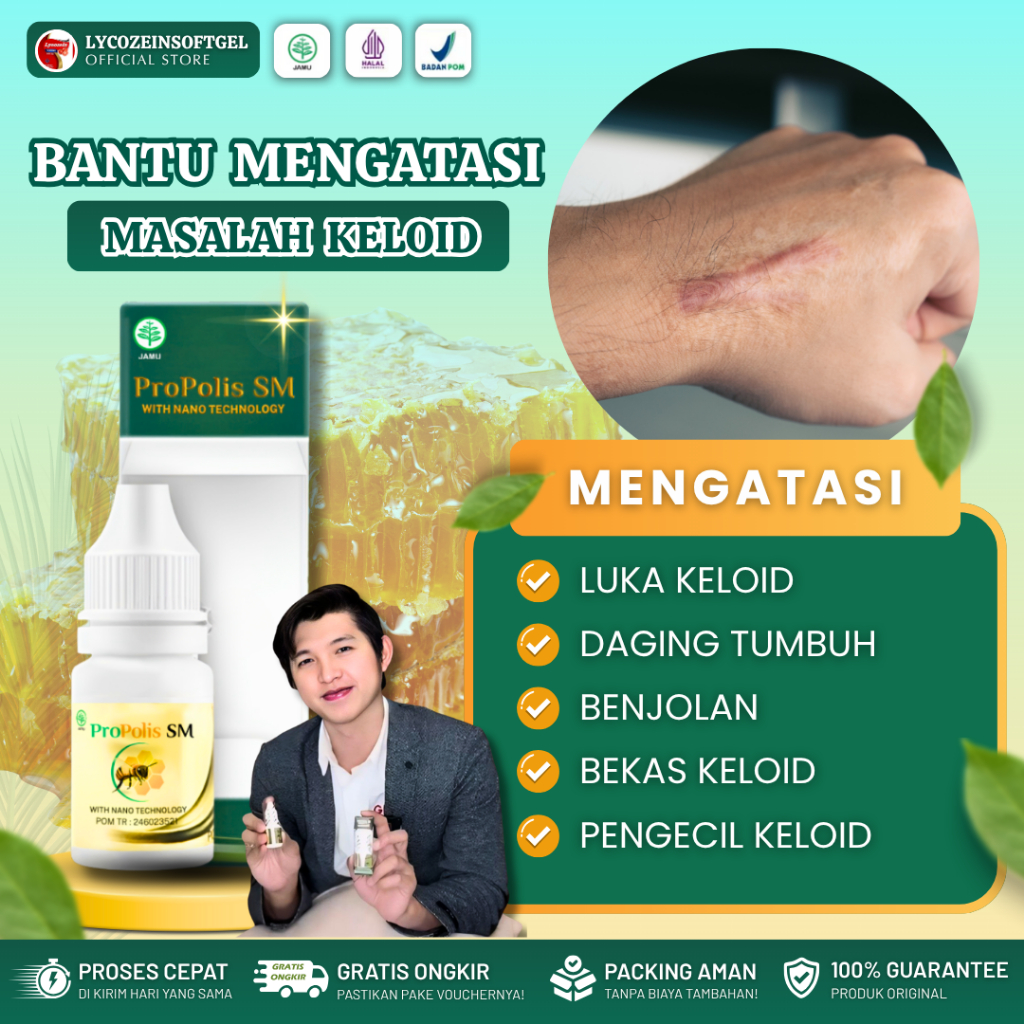 Obat Luka Keloid Daging Tumbuh Pengecil Keloid Benjolan Herbal Propolis Sm