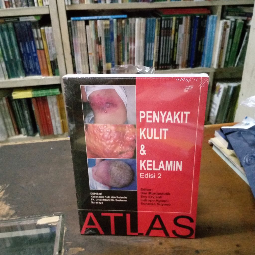 ATLAS PENYAKIT KULIT & KELAMIN Ed. 2 - DEP./SMF Kesehatan Kulit dan Kelamin FK. Unair/RSUD Dr. Soeto