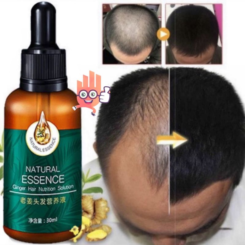 Natural Essence Ginger Hair Solution Penumbuh Rambut Perawatan Rambut 30ml