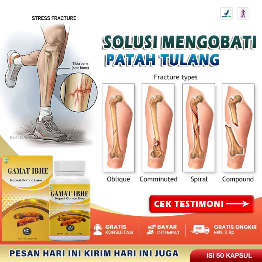 Obat Patah Tulang Paling Ampuh Penyambung Tulang Patah Vitamin Penambah Kalsium Patah Tulang Akibat 