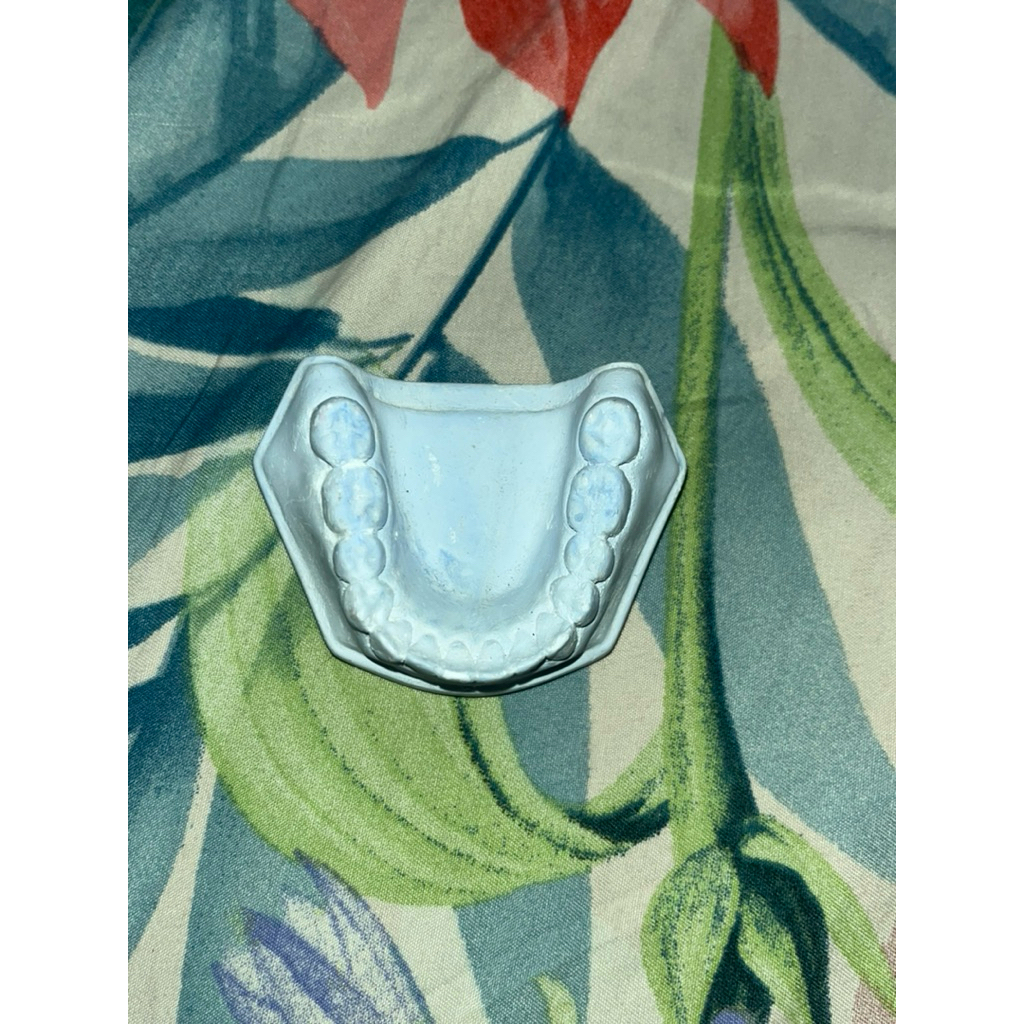 model gigi gips biru RAHANG BAWAH