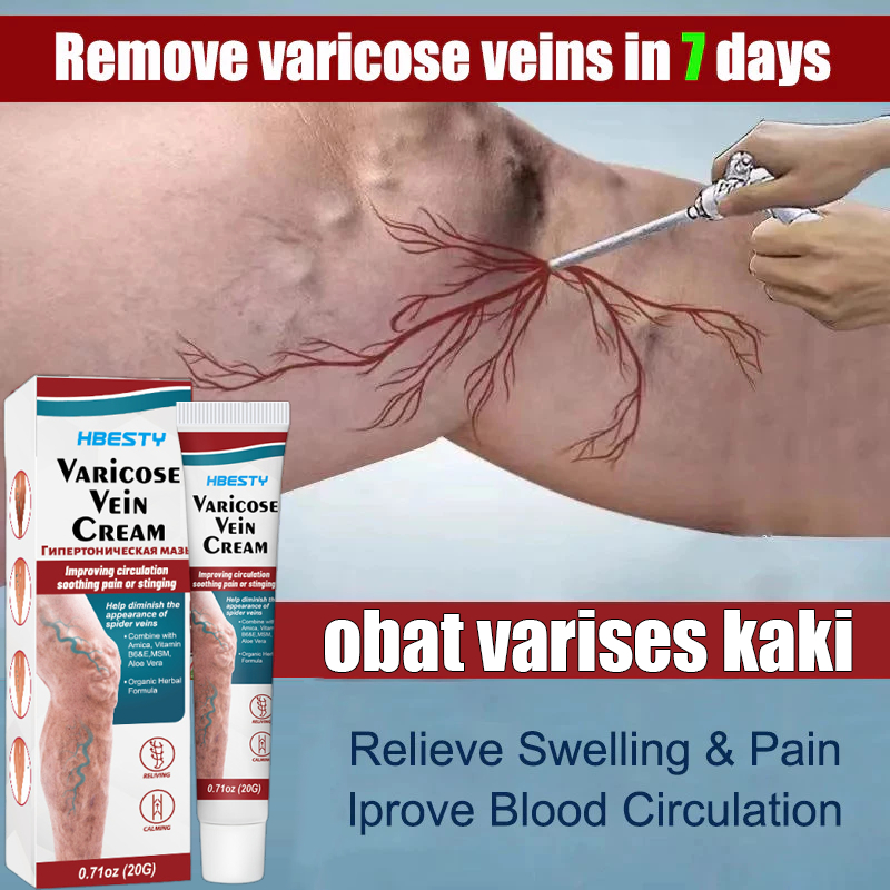 south moon AMPUH 100%Obat Varises Kaki Paling Ampuh, Varises & Vaskulitis Hilang Selamanya, Cepat Se