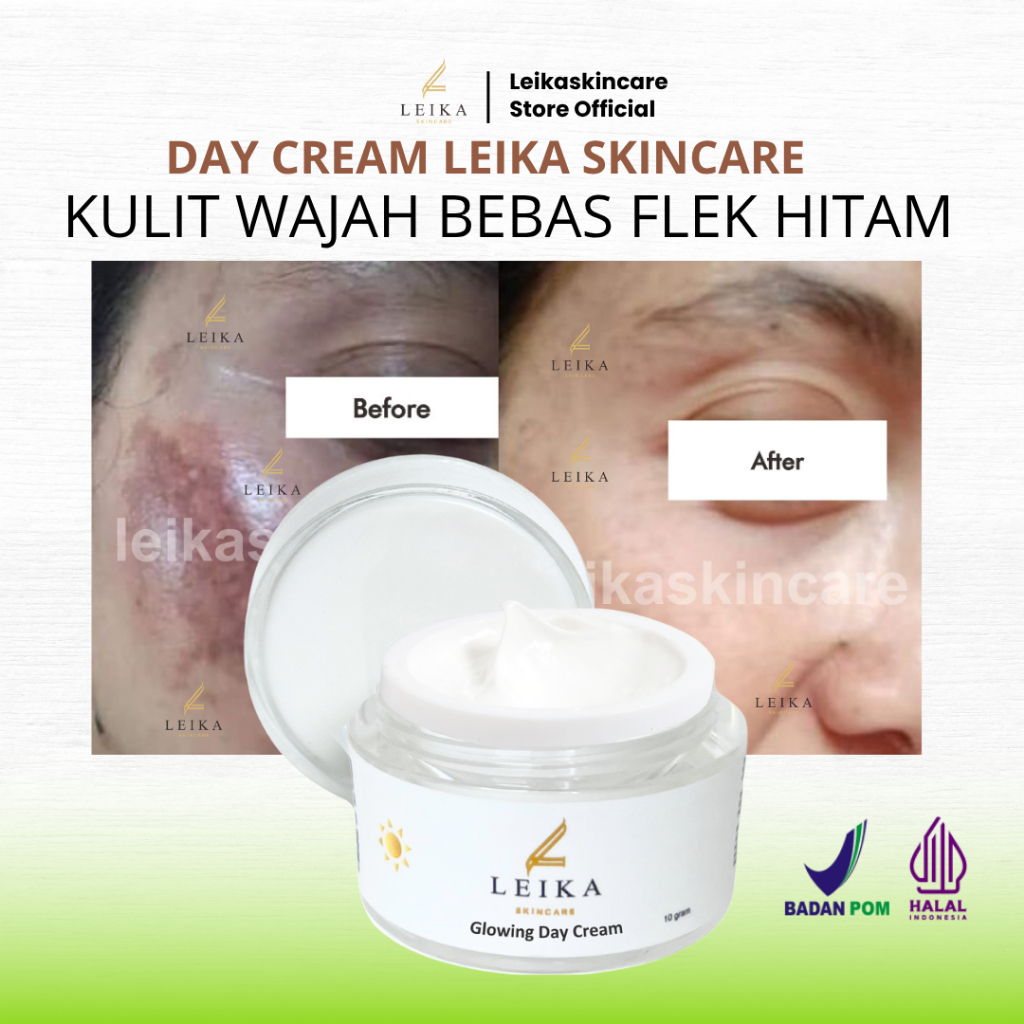 Leika skincare cream menghilangan flek hitam di wajah bpom mengangkat sel kulit mati melasma flek hi