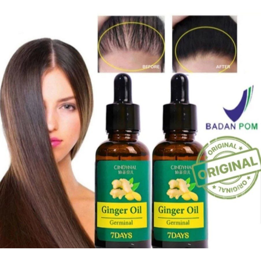 Cindynal Ginger Hair Growth oil 7 days