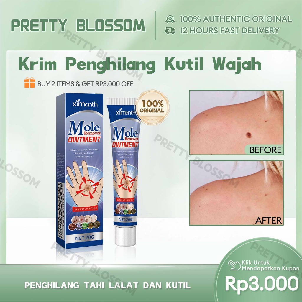 Ximonth 20g Salep Penghilang Tahi Lalat Dan Kutil Krim Penghilang Kutil Krim Penghilang Kutil Wajah 