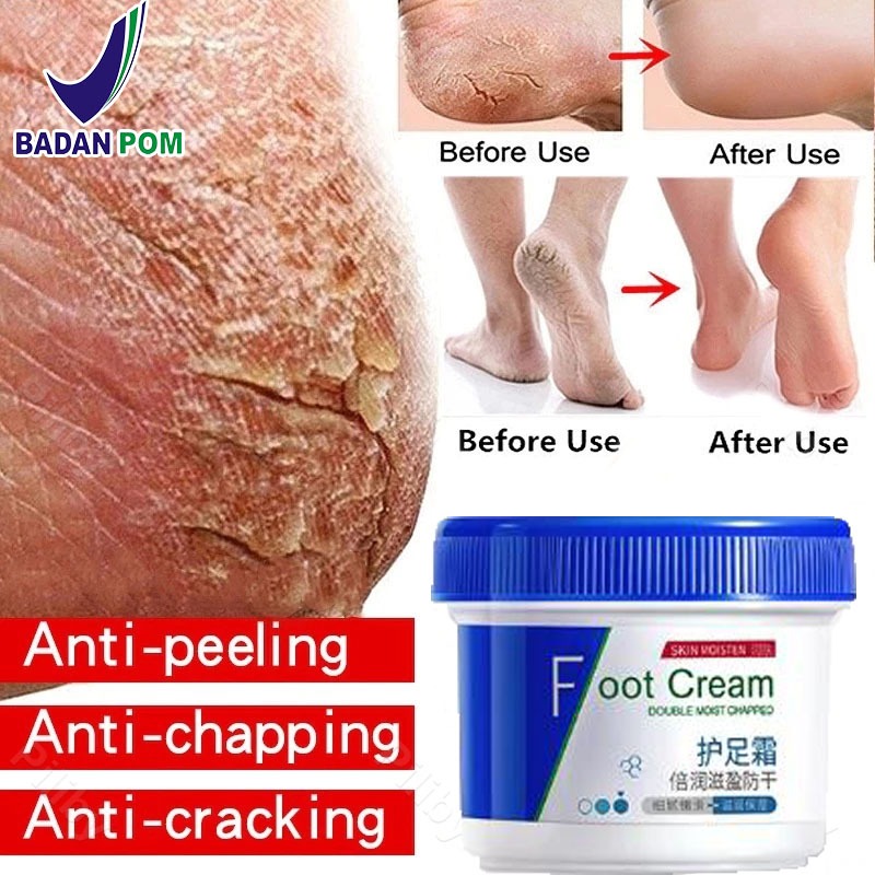 kaki pecah dan kering Foot cream Obat kaki pecah Pelembab kaki kering dan pecah Penghalus kaki kasar