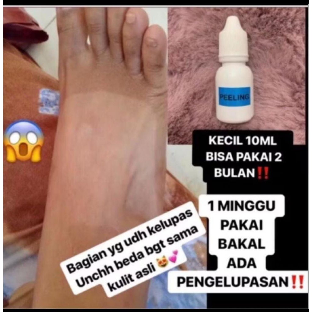 PENGELUPASAN KULIT BADAH TANGAN DAN KAKI 100ml
