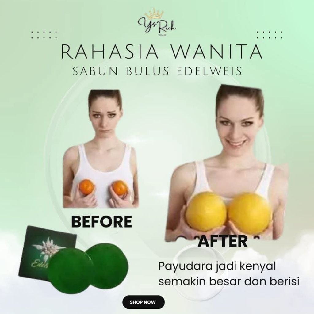 Sabun Edelweis Sabun Selaras Sabun Bulus Sabun Gatal Sabun Pembesar Pencerah Flek Hitam Jerawat Herb
