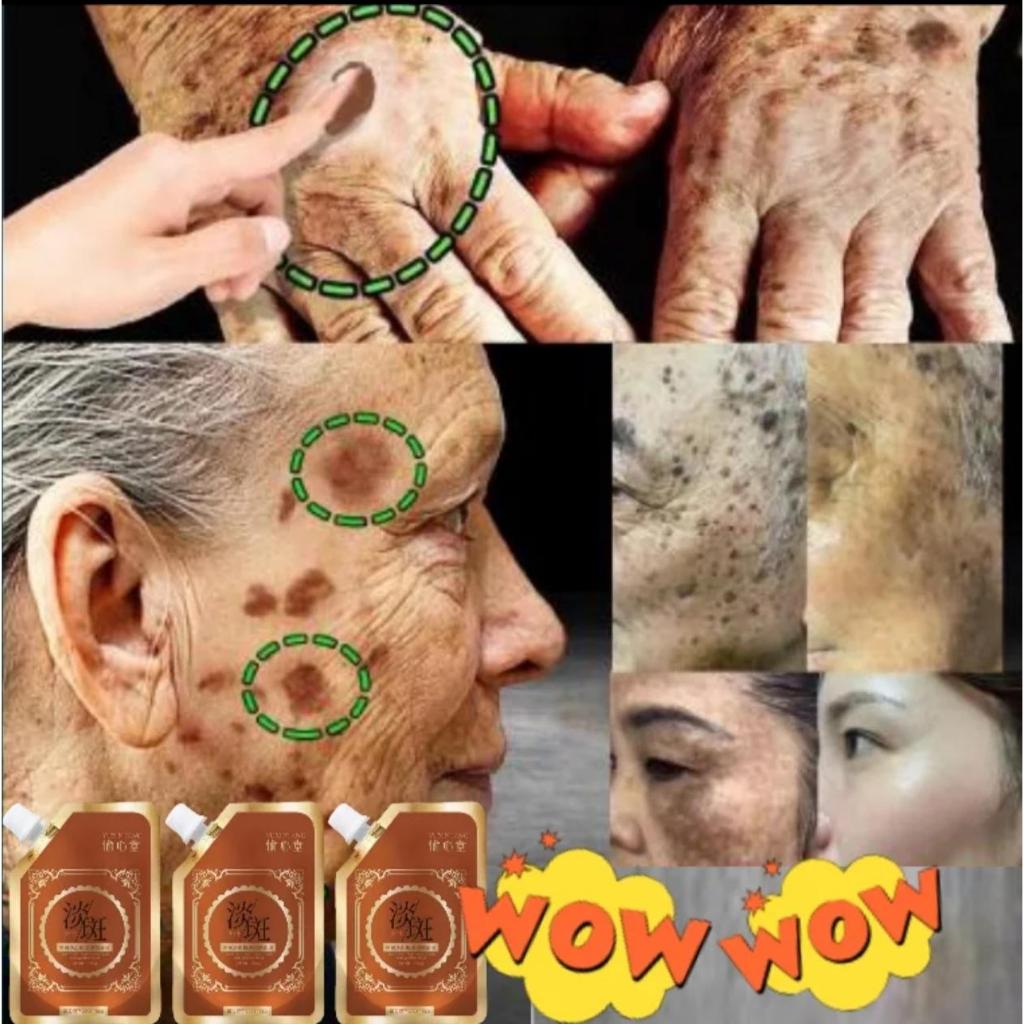 [Kulit] Topeng Koyak Tinggalkan untuk Memperbaiki Bintik Anti Penuaan & Anti Kedut Kolagen 100% Peny