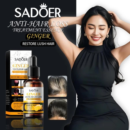Pertumbuhan rambut penumbuh rambut cepat Ginger King Serum Anti Botak obat penumbuh rambut Penumbuh 