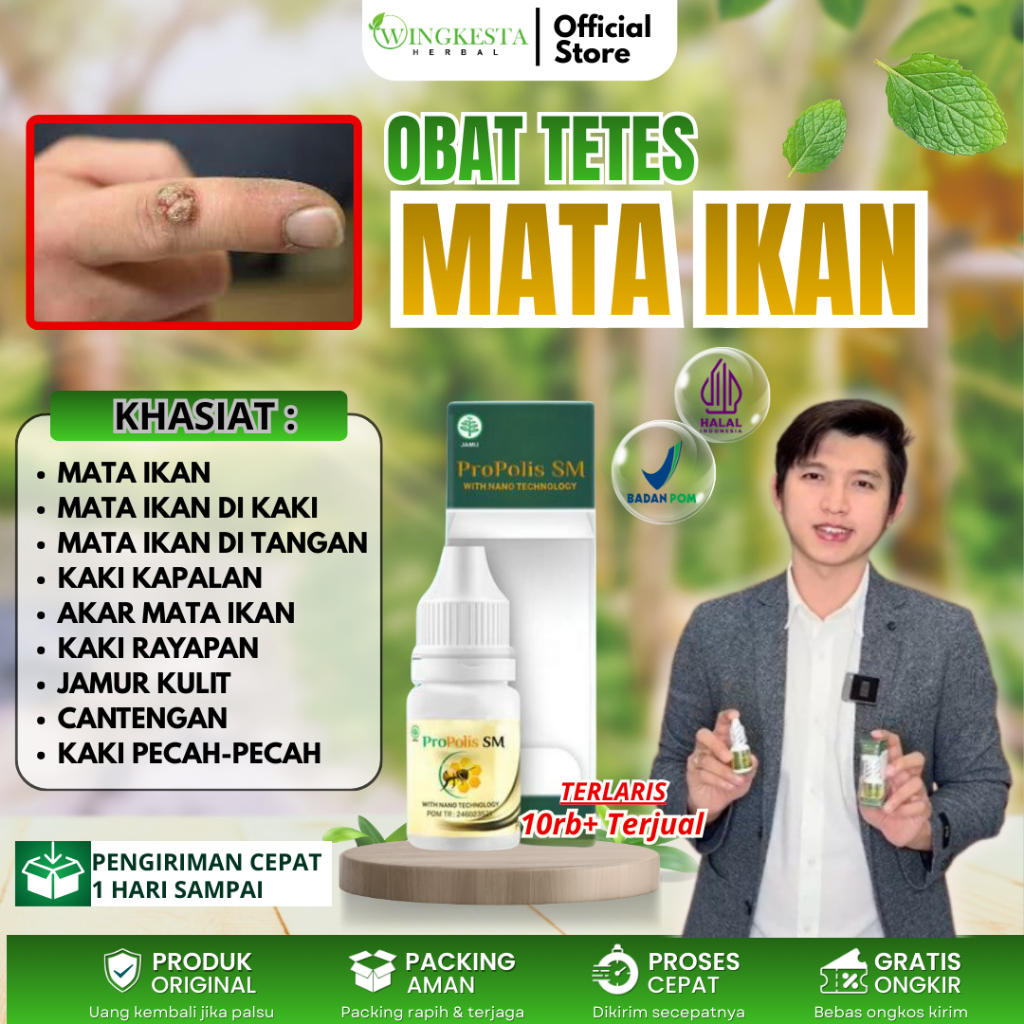 Obat Mata ikan, Obat Oles Mata ikan, Plester Penghilang Mata Ikan Kapalan Kaki Pecah Pecah, Obat Pen