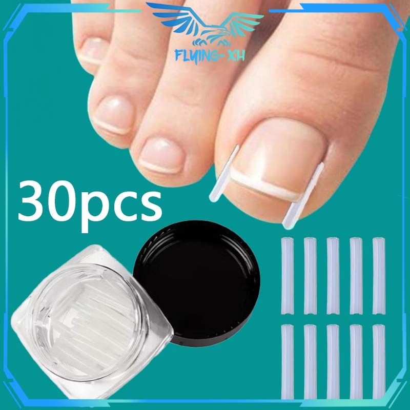 Bantalan Koreksi Kuku Kaki 30pcs Bantalan Kuku Cantengan Silikon Ingrown Nail Correction Nail Isolat