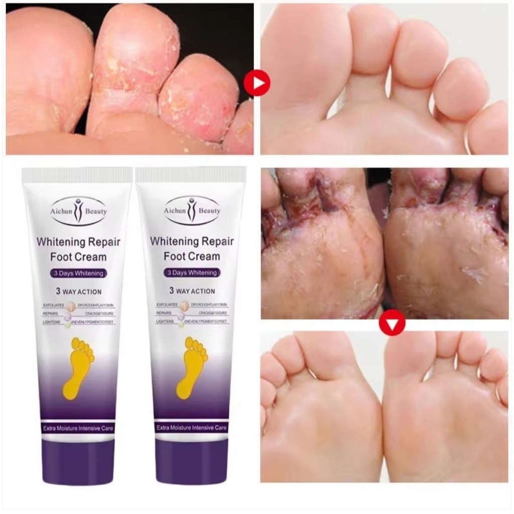 AICHUN BEAUTY WHITENING REPAIR FOOT CREAM