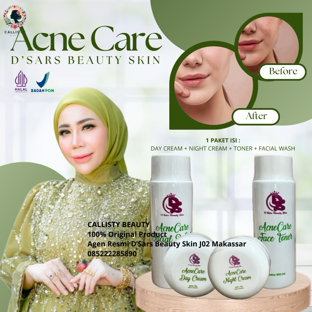 D'Sars Cream Acne Care | Paket Acne Dsars | Acne Care D'Sars Beauty Skin | Dsars Paket Acne Care