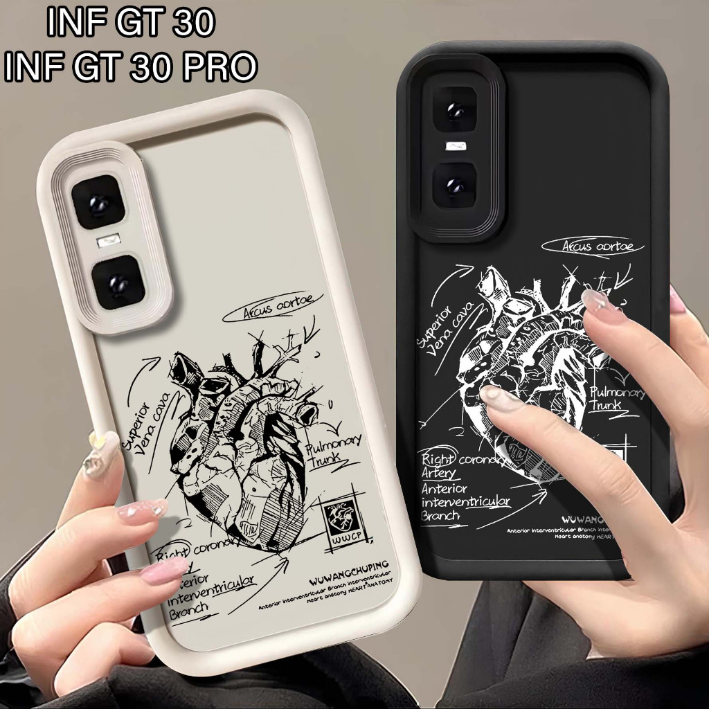 Softcase Rubber Infinix GT 30 GT 30 PRO - Sarung Hp Infinix GT 30 GT 30 PRO - Case Hp Infinix GT 30 