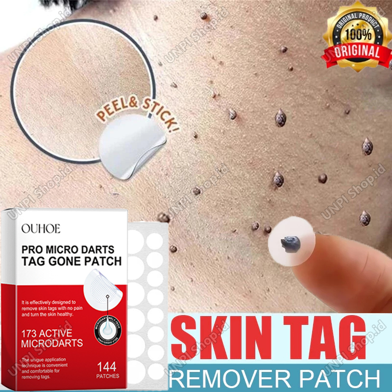 Stiker Penghilang Kutil Dan Tahi Lalat Di Wajah Obat Penghilang Kutil Di Leher Obat Kutil Mata Ikan 