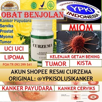 CURZEMA OBAT MIOM II CURZEMA OBAT MIOM ATAU KISTA II CURZEMA OBAT MIOM AMPUH II CURZEMA OBAT MIOM KI