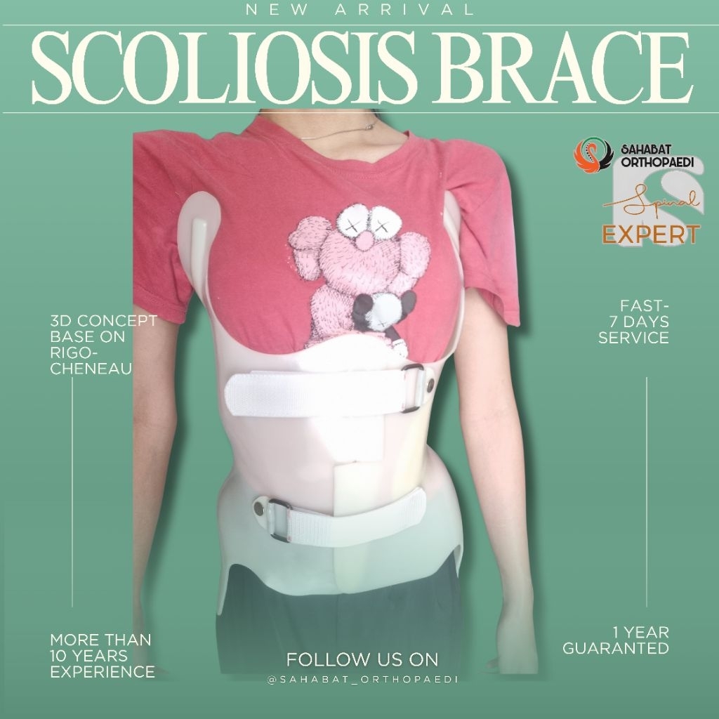 Scoliosis Brace 3D custom