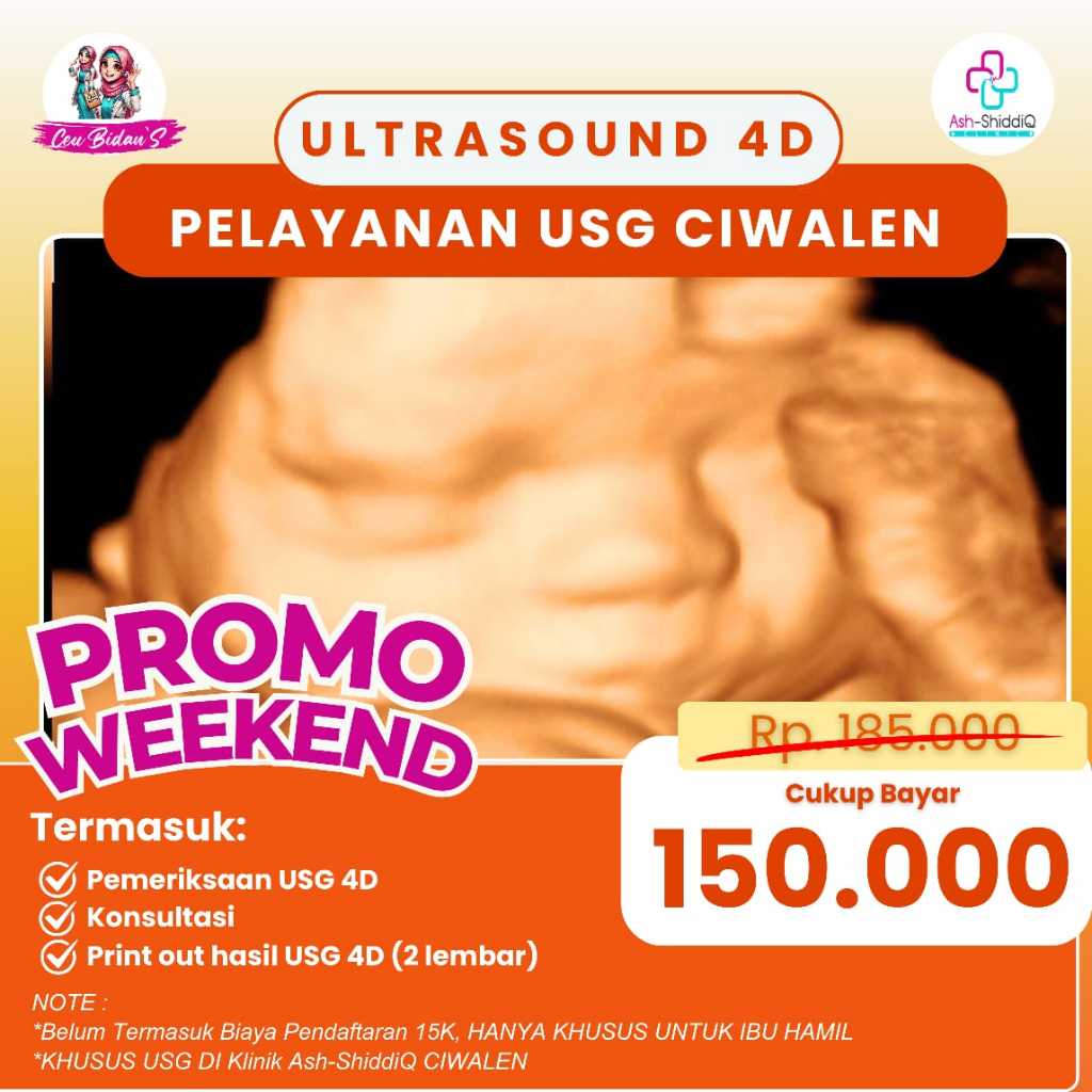 USG 4D PROMO WEEKEND DESEMBER- Best Deal, Print Out hasil USG 4D (2), Konsultasi, Pemeriksaan USG 4D