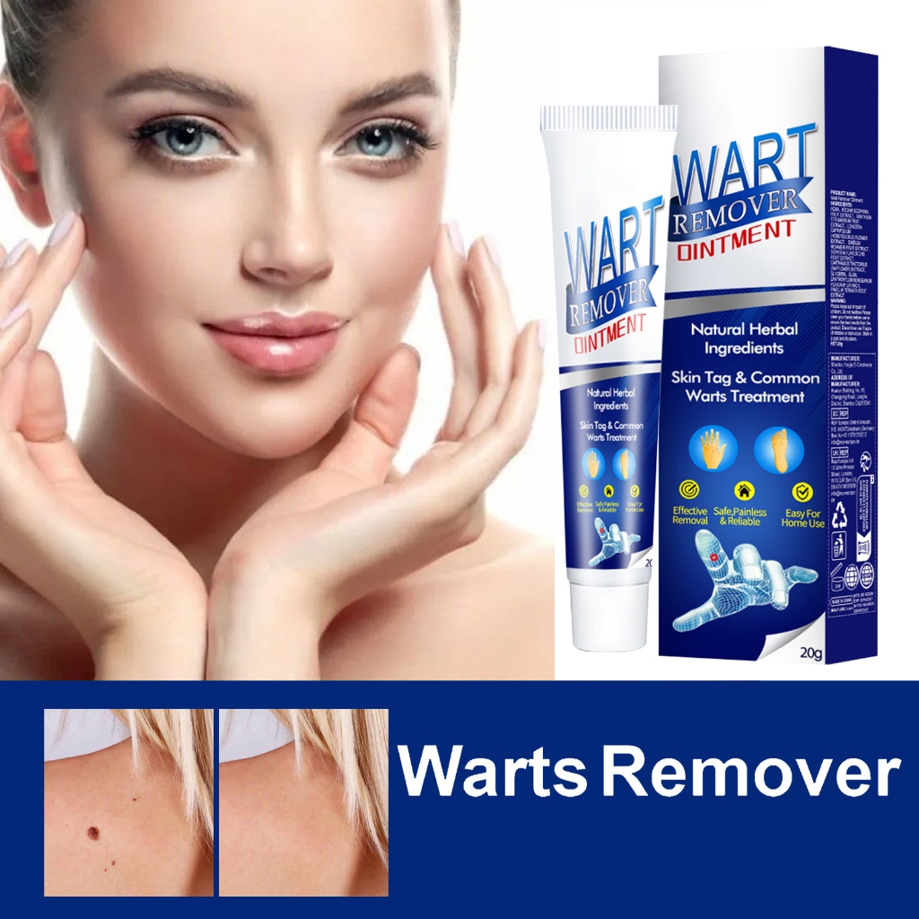 EELHOE kutil dan tahi lalat penghilang cream 20g salep penghilang kutil salep kutil Penghilang Kutil
