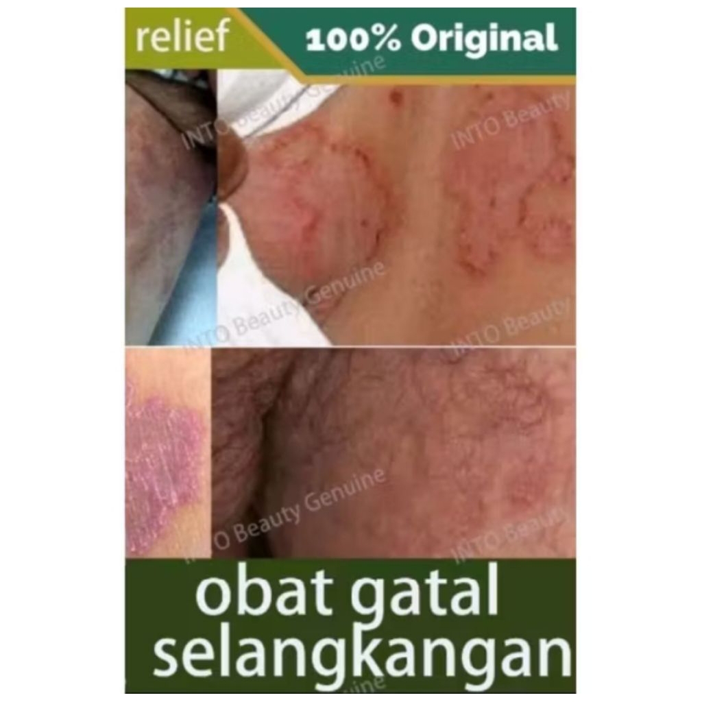 SALEP GATAL GATAL DIJAMIN AMPUH