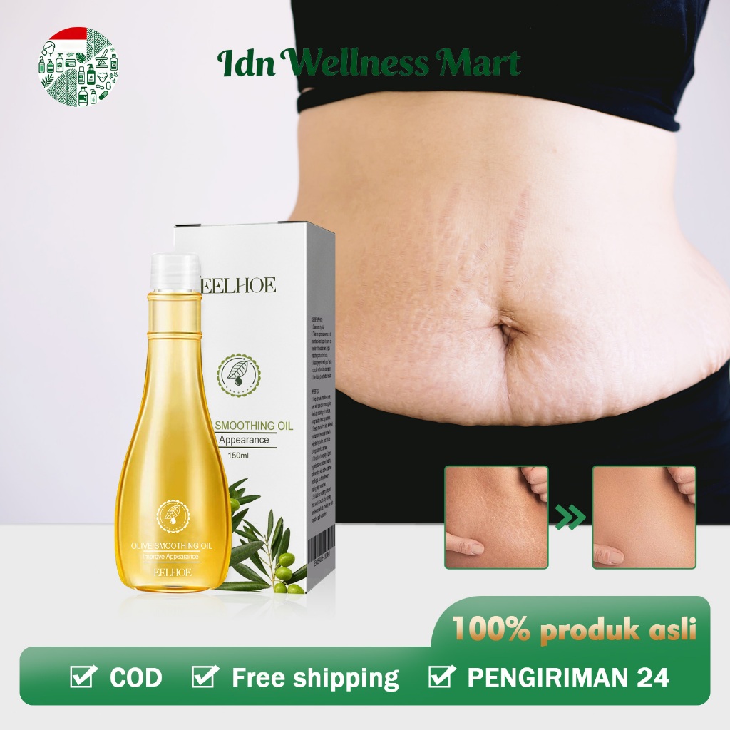 EELHOE Penghilang Stretch Mark Oil 150ml Penghilang Strechmark Olive Smoothing Oil Scar Repair Oil P