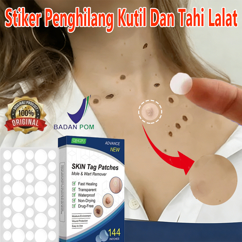 Sticker Penghilang Kutil Dan Tahi Lalat Obat Kutil Di Wajah Penghilang Kutil Di Leher Wart Remover P
