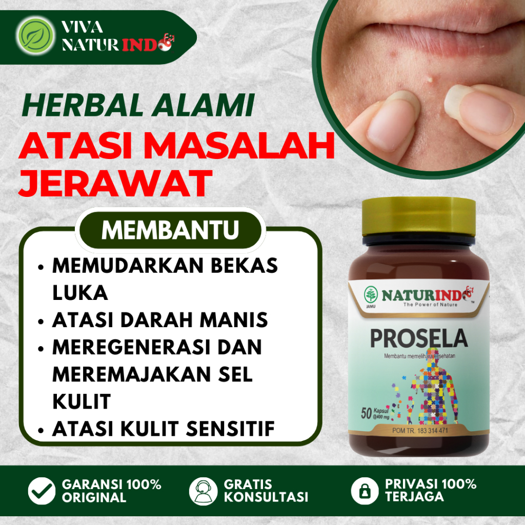 Obat Jerawat Dan Bekas Jerawat Batu Herbal Jerawat Punggung Pria Dan Wanita Bruntusan Wajah