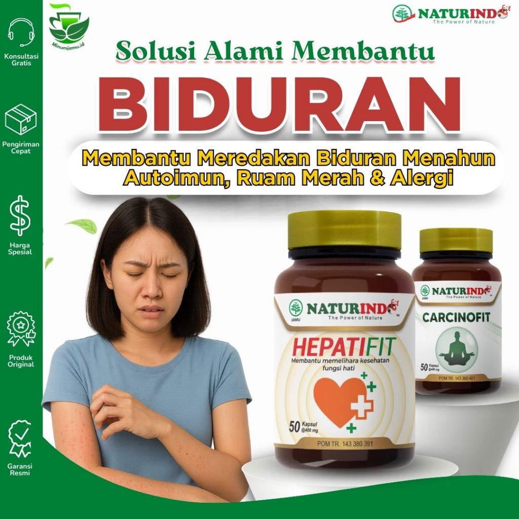 Obat Biduran Alergi, Obat Biduran, Obat Biduran Alergi Ampuh, Obat Biduran Alergi Ampuh, Obat Bidura