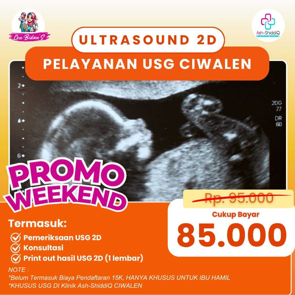 USG 2D PROMO WEEKEND - Best Deal, Print Out hasil USG 2D (1), Konsultasi, Pemeriksaan USG 2D