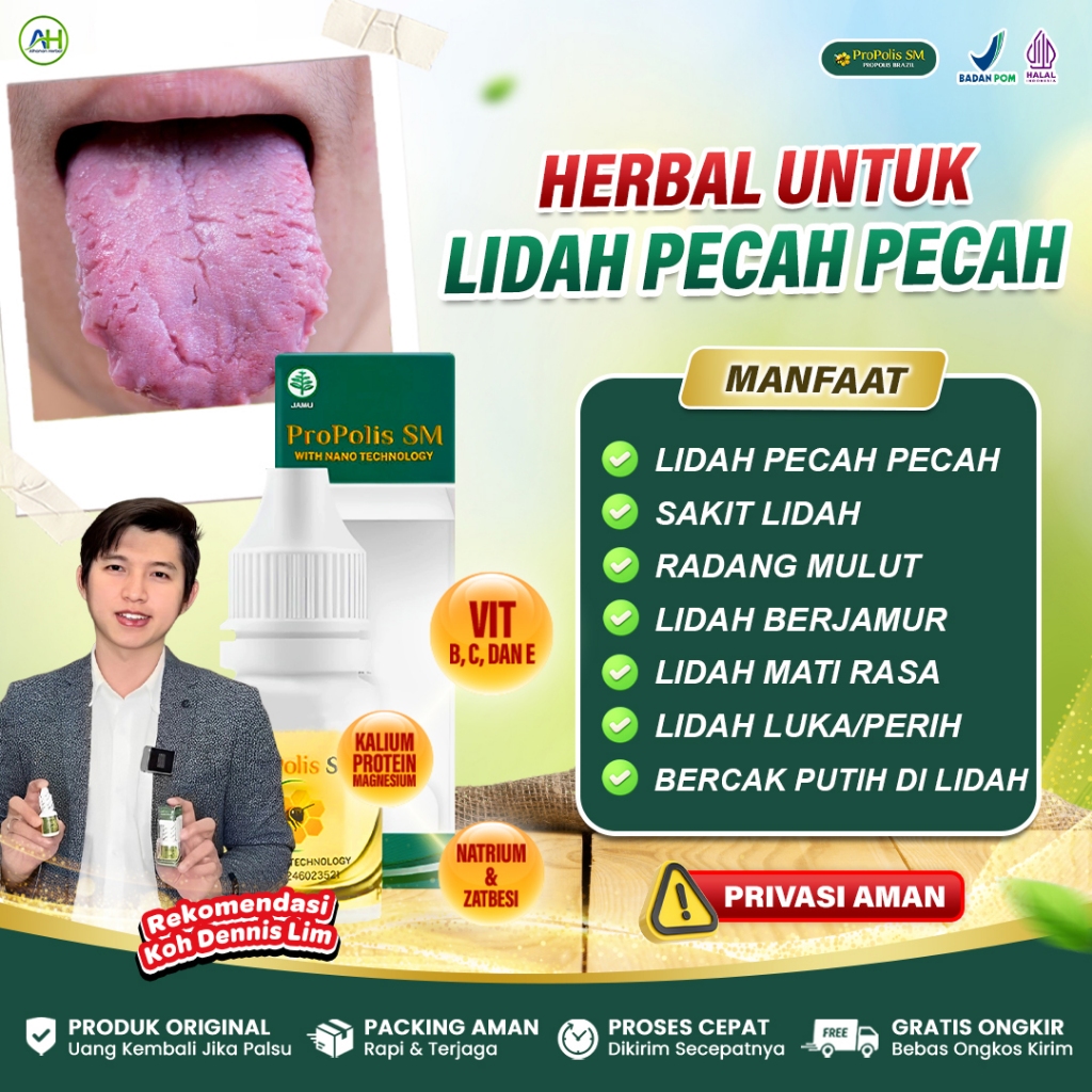 Obat Lidah Putih Berjamur, Lidah Pecah Pecah, Lidah Mati Rasa, Lidah Luka Perih - Propolis SM Asli