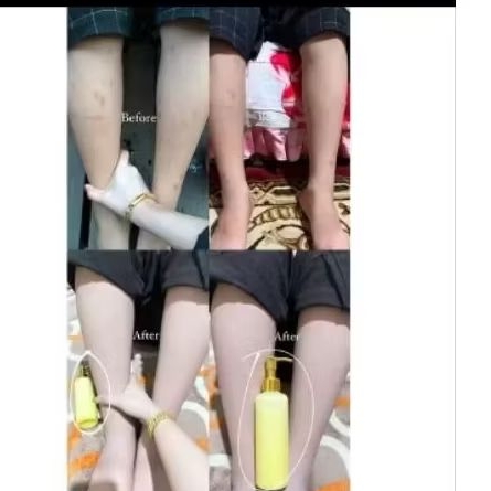 SABUN BOOSTER WHITENING