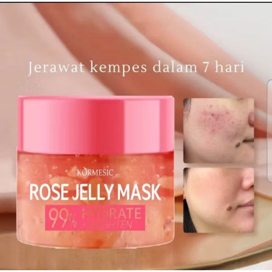 Moisturize Rose Jelly Mask  | Masker Wajah | Jerawat | Bruntus | Bopeng | Bekas Jerawat | Kemerahan 