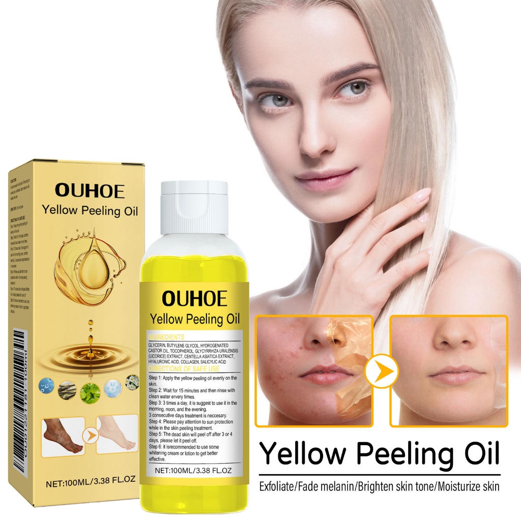 Ouhoe Yellow Peeling Oil Dark Spot Remover Whitening Skin Brightening Body Exfoliating Minyak Pengup