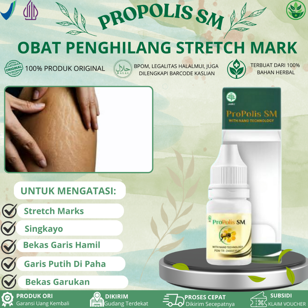 Propolis SM Untuk Stretch Mark, Singkayo di Paha Betis, Guratan/Garis Di Kulit, Garis Kerutan Putih,