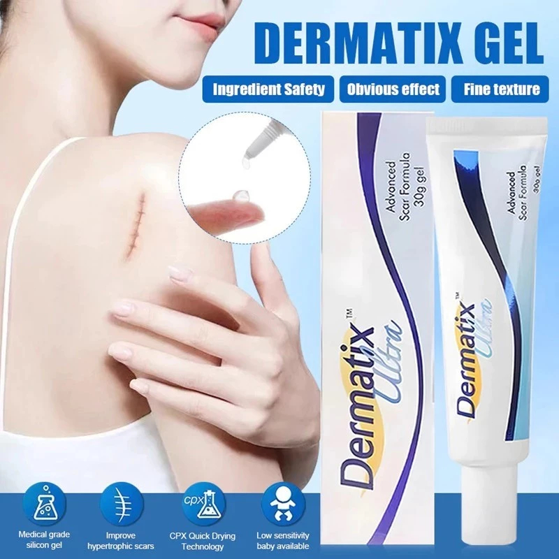 COD Dermatik Ultra / Dermatic / Dermatix Ultra 15Gr Cream Krim Penghilang Bekas Luka 15 gram strechm