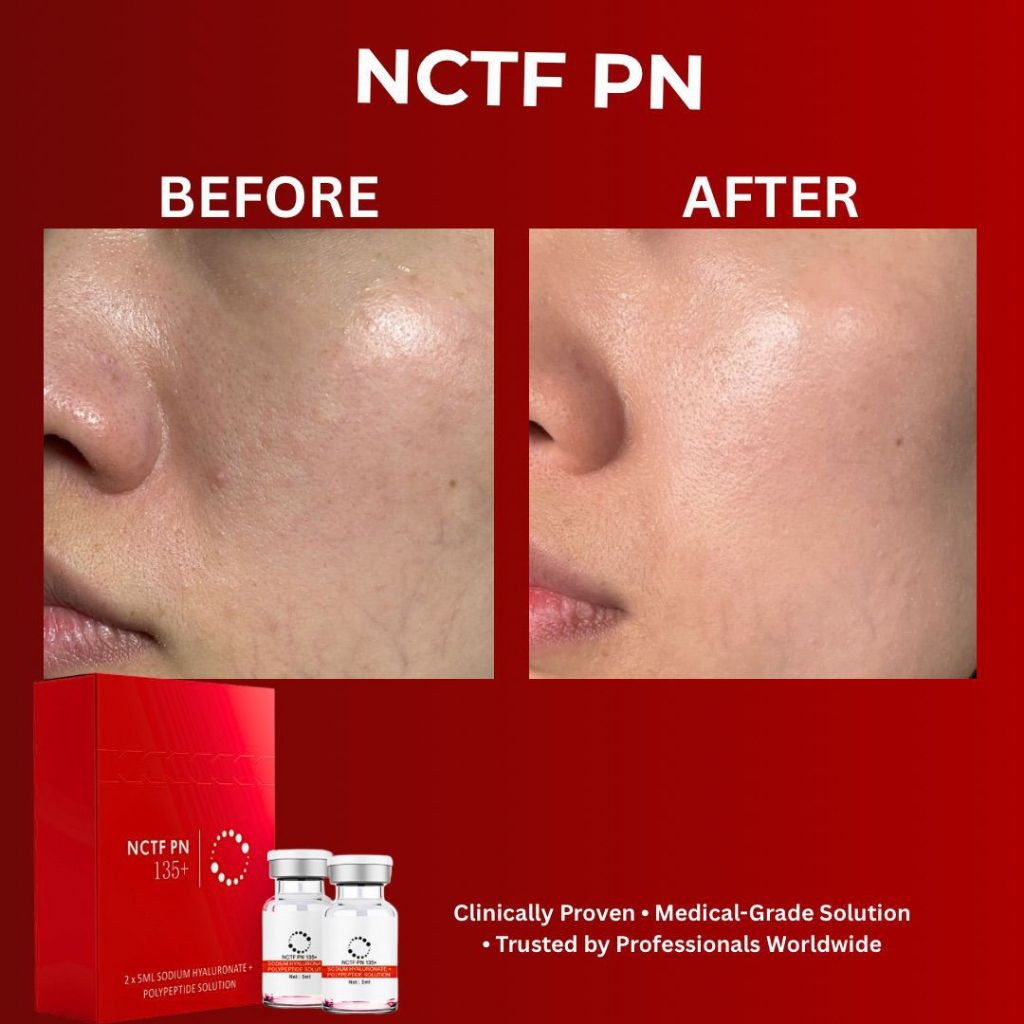 Skinbooster NCTF 135HA - Pelembab Wajah, Regenerasi Kulit, Anti Penuaan