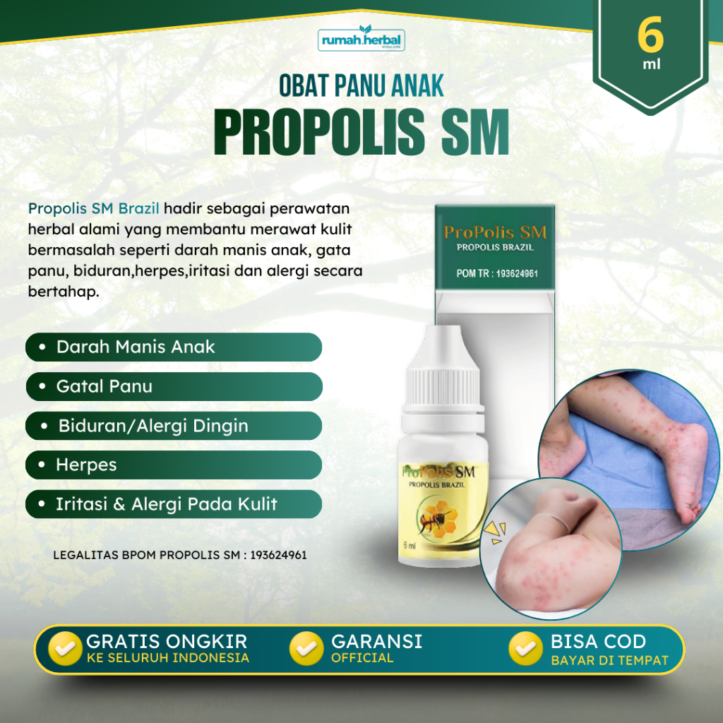 Propolis SM Brazilian - Obat Panu Anak Salep Gatal Kulit Selangkangan Panu Kadas Kurap Exim Jamur Ku