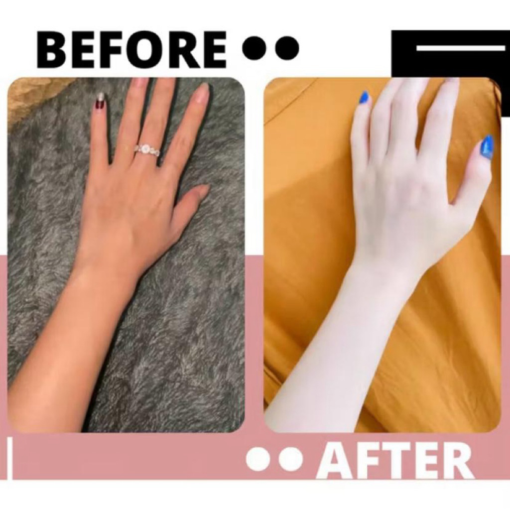 PAKET HB DOSTING ISI 2 khusu kulit susah putih 20x lebih cepat memutihkan ll lotion pemutih badan ll