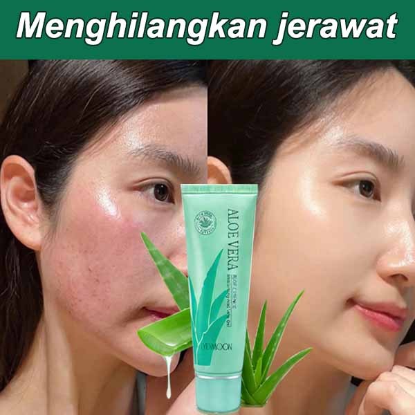 Hydrating Aloe Vera Gel Acne Aloe Vera Gel  Multifunction Gel Memperbaiki Bekas Jerawat Pelembab kul
