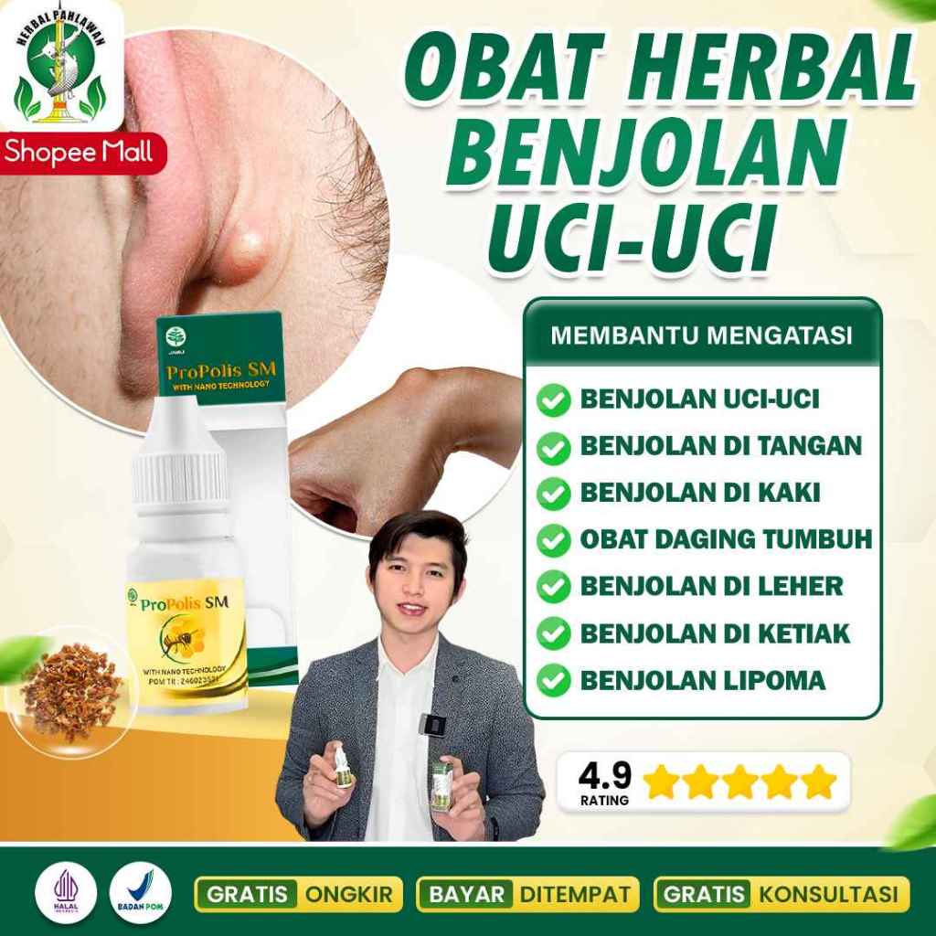 Obat Untuk Benjolan Uci Uci, Benjolan di Tangan, Kaki, Daging Tumbuh, Benjolan di Leher, Ketiak - Pr