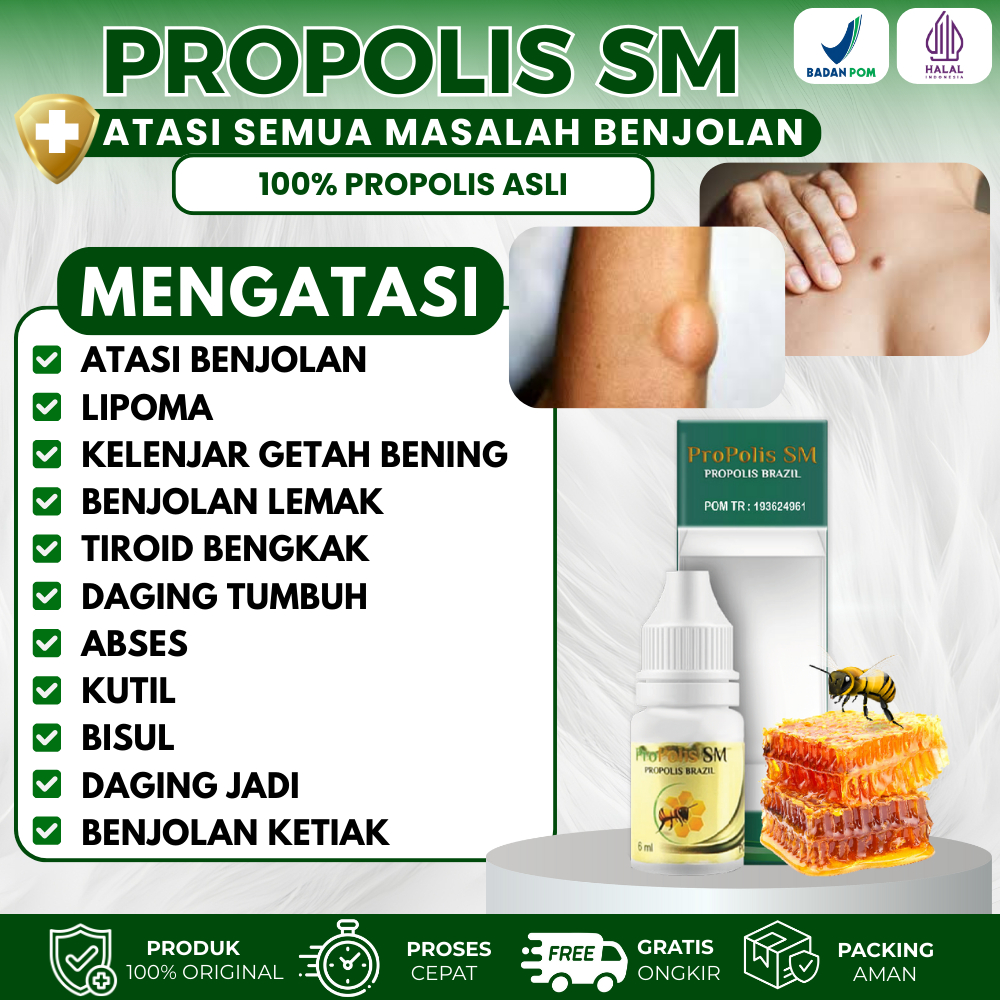 Obat Oles Benjolan, Lipoma, Kelenjar Getah Bening, Benjolan Lemak, Tiroid Bengkak, Daging Tumbuh, Ab